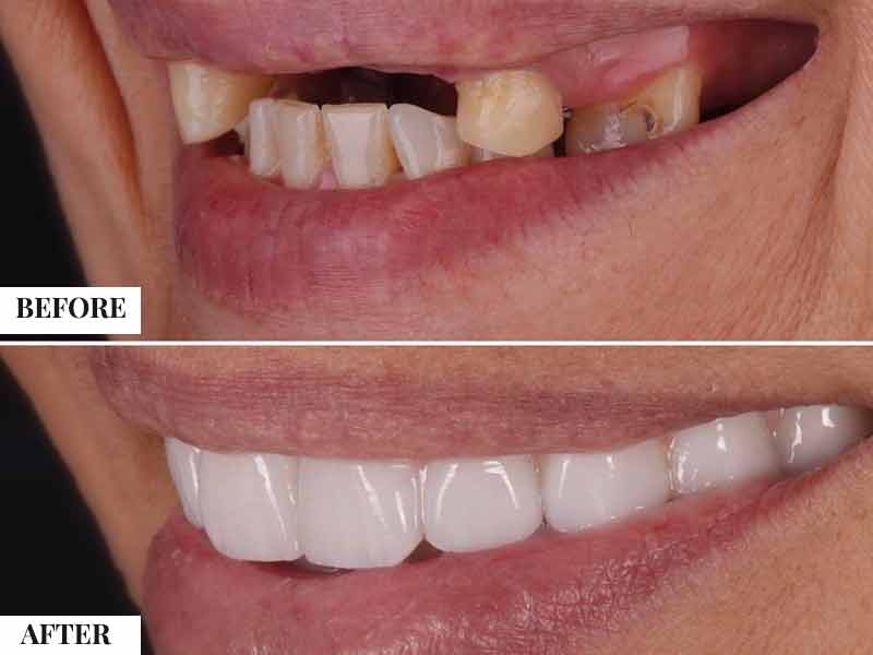 Why Calgary Patients Choose Stunning Dentistry