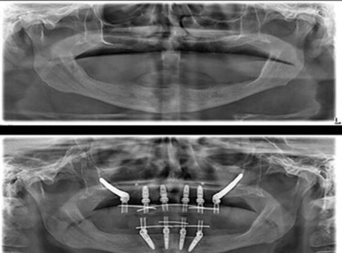 After You Return: Post-Treatment Follow-Up