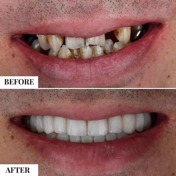 Smile Makeover - photo 2